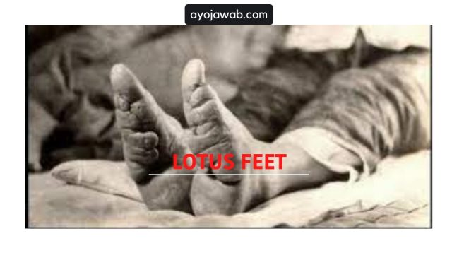 Lotus Feet, Simbol Kecantikan Ekstrim Wanita Cina